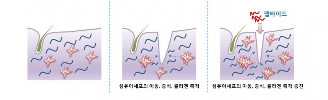 정상적인 피부(왼쪽)가 상처가 나면(가운데) - 연세대 제공